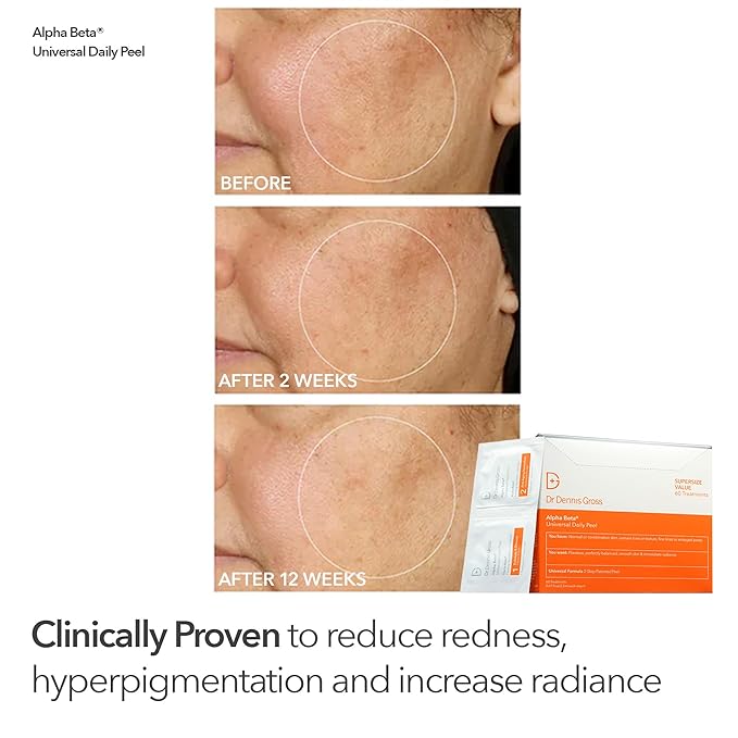 Dr Dennis Gross Peel Vault Kit – 30 Alpha Beta® Extra Strength Daily Peels + 60 Universal Daily Peels | 90 Total Treatments | $245 Value Limited Edition