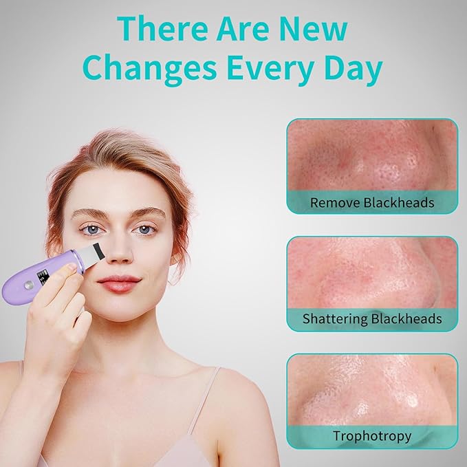 Skin Scrubber Facial Spatula - 4-in-1 Deep Cleansing Tool for Pore Extraction, Fast Charging Dock Blackhead Remover Face Spatula for Facial Skincare Women Gift (Purple)