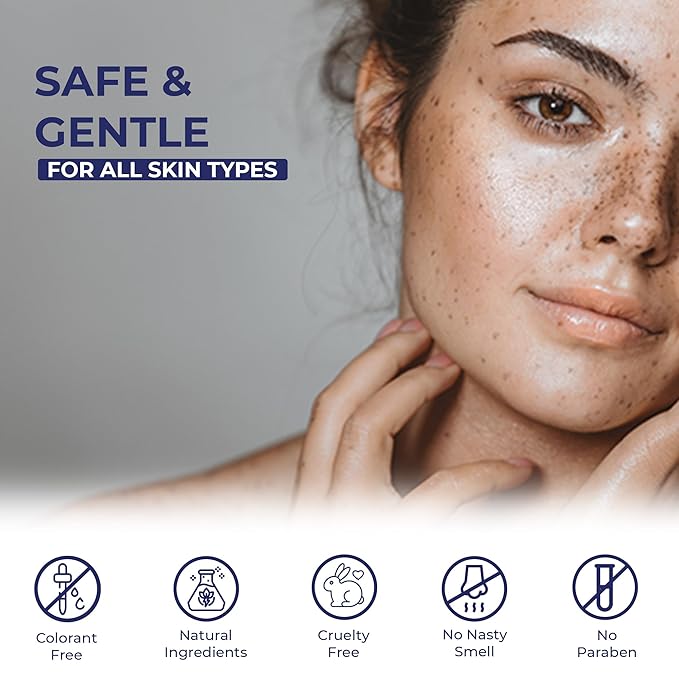 Melasma Treatment for Face - Melasma Cream & Age Spot Remover for Skin Discoloration, Post-Blemish Marks, Scars & Spots | Dark Spot Remover for Face & Body