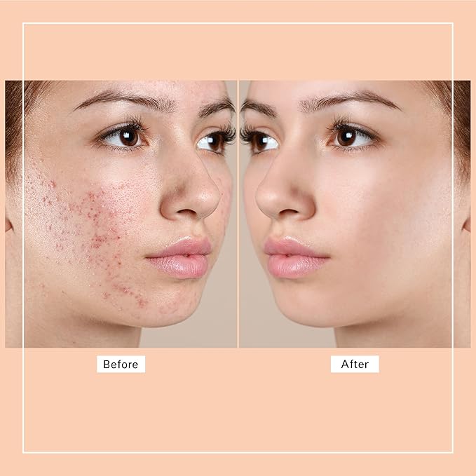 Wellness Heavens Foaming Facial Cleanser for Women & Men, Oil-Free Hydrating Gentle Face Cleanser for Sensitive Skin with Glycolic Acid, Hyaluronic Acid & Aloe, Soap Free, 3.38 fl. Oz.