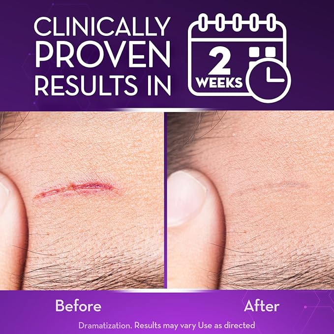 Cicatricure Advanced Scar Gel for Face & Body - Proven Results in 2 Weeks, Scar Treatment for Surgical Scars, Stretch Marks, Scars of Burns and Injuries, Acne Scar Treatment, 1 oz (28 g) - Pack of 2