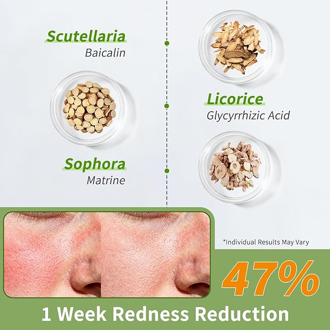 Squalane Matte Daily Face Moisturizer Cream with Hyaluronic Acid - 72H Hydration, Barrier Repair, Calms Redness | Fragrance-Free, Derm-Tested for Women & Men with Ultra Sensitive & Dry Skin