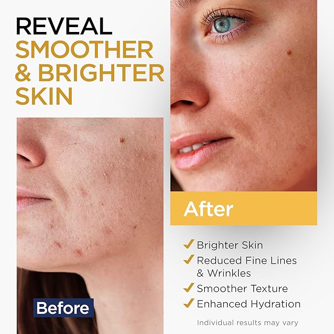 Vitamin C Serum for Face with Stem Cells Hyaluronic Acid Vitamin E Aloe Vera For All Skin Types Anti-Aging Face Seru Supports Skin Health & Even Tone Day and Night Made in USA 1 Oz