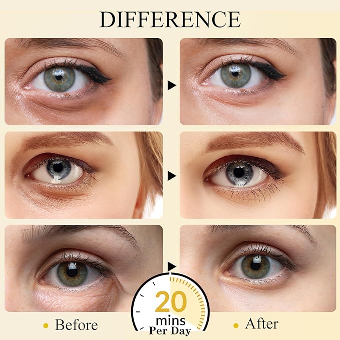 Under Eye Patches(30 Pairs), 24K Gold Eye Mask for Dark Circles, Puffy Eyes and Wrinkles, with Hyaluronic Acid & Collagen