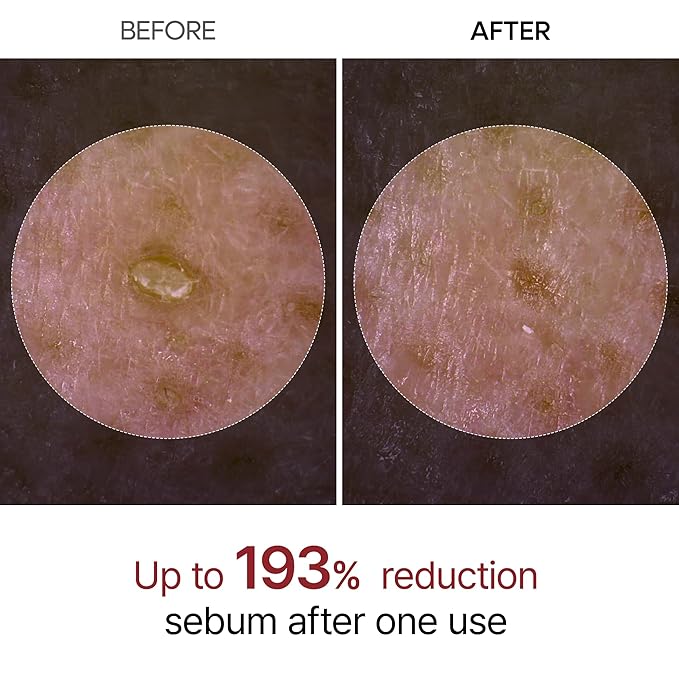 Peel Shot Glow White and Black Rice Ampoule Duo, Soft Exfoliating Face and Body Scrub Dead Skin Cells, Blackheads Remover for All Skin Types