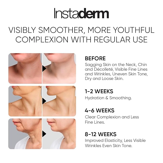 Neck and Décolleté Firming Cream – Tightening & Lifting Treatment for Crepey, Wrinkles, sagging Skin & Vertical Lines. Anti-Aging Peptide Formula to Boost Hydration & Collagen in the Skin.