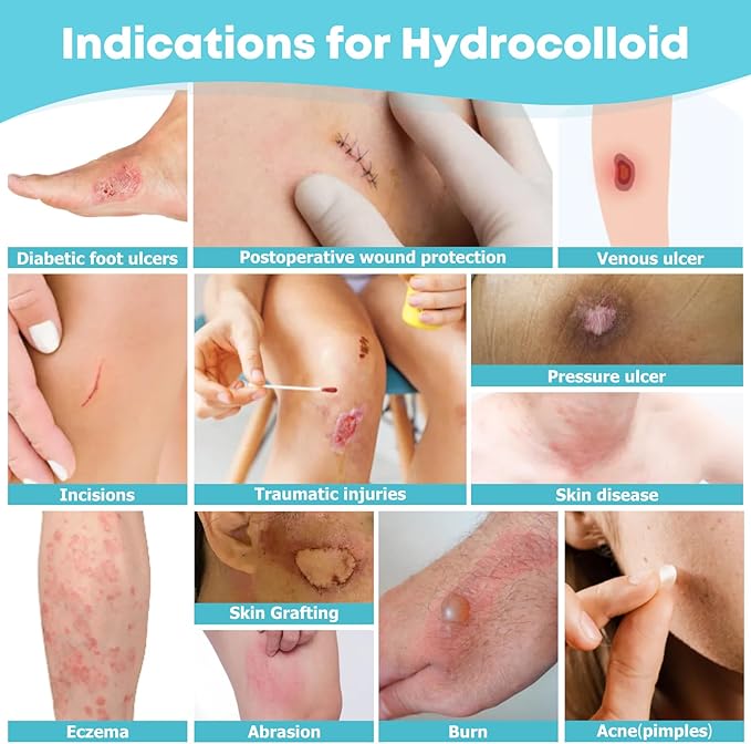 LIFARA Hydrocolloid Roll for Wound Care - Cut-to-Size, Extra Large Hydrocolloid Patch Bandages with Self-Adhesive, Ultra Absorbent, Flexible & Waterproof, First Aid Kit Essential (2in*16ft)