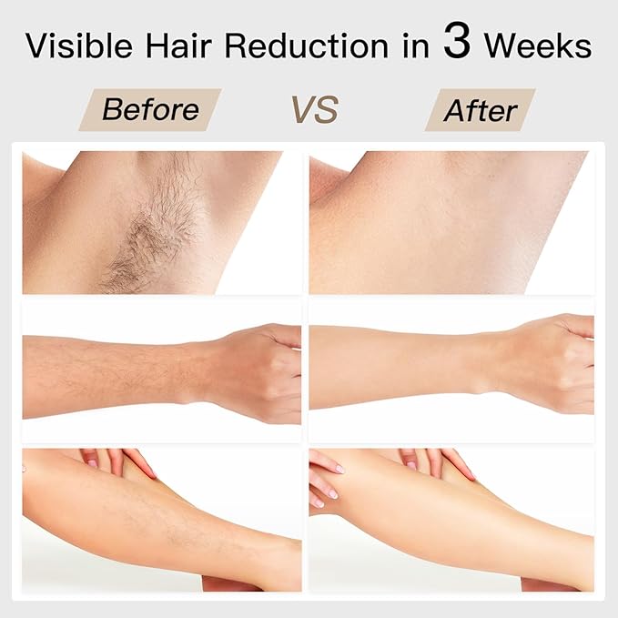 Laser Hair Removal, BoSidin IPL Hair Removal with Painless Ice-Cooling, 2-in-1 Face SR Rejuvenation, 6+1 Modes, 6 Levels Hair Removal for Women Permanent, Laser Hair Removal Kit with Shaver, Goggles