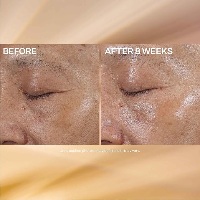 StriVectin Super-C Eye Vitamin C Eye Cream, Brightening and Firming, Boost Skin Dullness with Hyaluronic Acid, 0.51 Oz