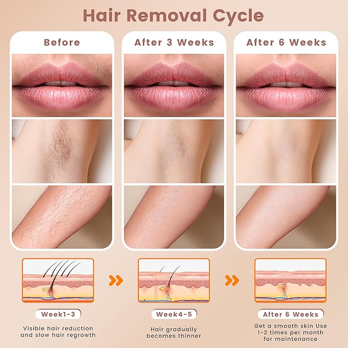 IPL Hair Removal Device, Hair Removal for Women and Men at home for Armpits Legs Arms Bikini Line，model S3
