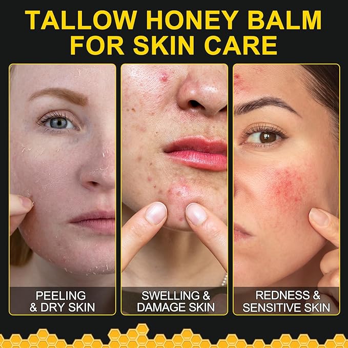 Beef Tallow for skin, Beef Tallow, Hydrating Tallow Balm with Raw Honey and Beeswax, Grass-Fed Beef Tallow & Raw Wild Honey Blend, Body & Face Moisturizer, Natural Formula