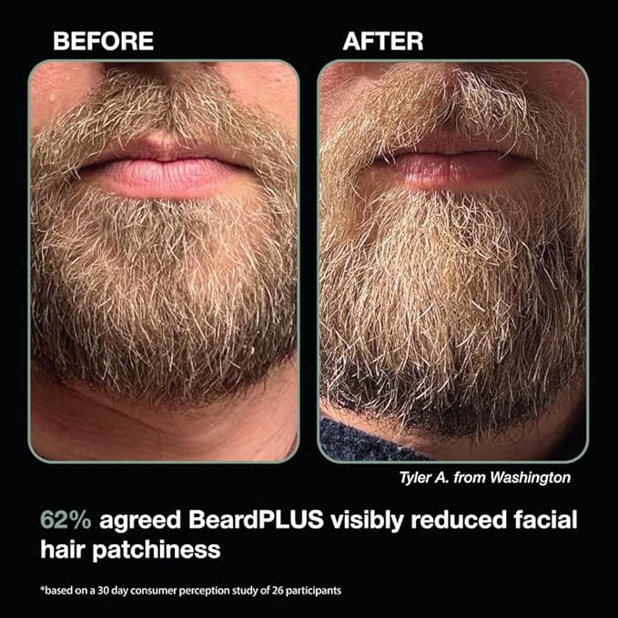 ZEUS BeardPLUS Conditioner for Men, Enhanced Beard Growth & Hair Care Treatment with Biotin & Caffeine to Boost Thickness, Strength, Hydration, and Skin Comfort (Made in USA) 6 oz.