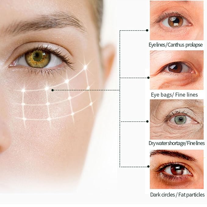 Eye Cream For Dark Circles, Anti Aging Eye Cream With Vitamin C, Hyaluronic-acid & Orange Extract, Under Eye Cream For Puffiness And Bags, Eye Cream For Reduce Fine Lines, Wrinkles & Dark Circles