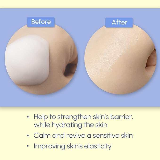 SURMEDIC Azulene Moisturizing Soothing Mousse Toner, Hydrating, Glowing, Calming Bubble Toner for Sensitive, Dry, Dull Skin, Korean Skin Care 3.71 oz / 110ml