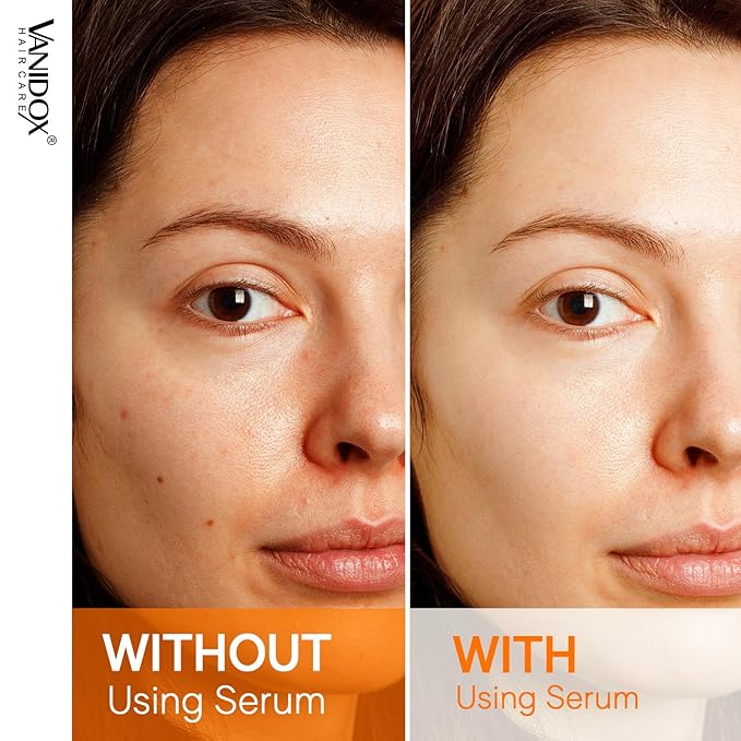 Super Vitamin C Serum for Women Over 70, All-In-One Formula, Made in USA, Hydrates, Firms, Lifts, and Targets Wrinkles, Age Spots, and Fine Lines, Vitamin C Serum (1fl oz)