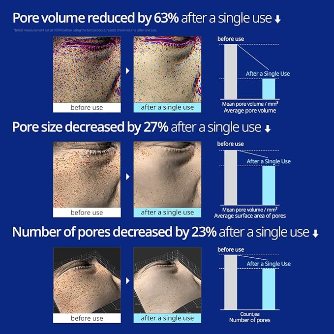 Saunan Heating Salt Mask(3.17 oz) - Top Finnish Sea Sauna Salt Mask for better skin. Healing dead skin cells and effective pore reducer. No more blackheads.