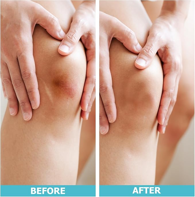 LIFARA Hydrocolloid Roll for Wound Care - Cut-to-Size, Extra Large Hydrocolloid Patch Bandages with Self-Adhesive, Ultra Absorbent, Flexible & Waterproof, First Aid Kit Essential (2in*16ft)