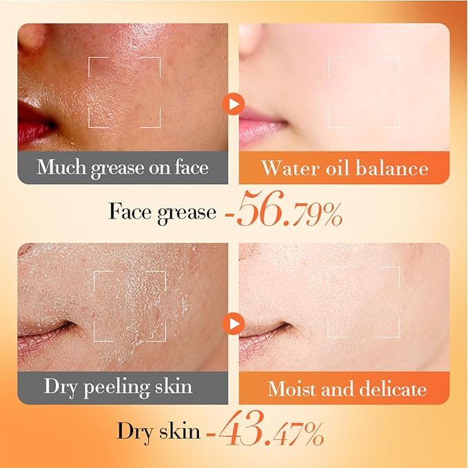 Vitamin B5 face routine set for women - women's skin care set - facial care set - Promote skin metabolism, moisturize, reduce oil, repair skin