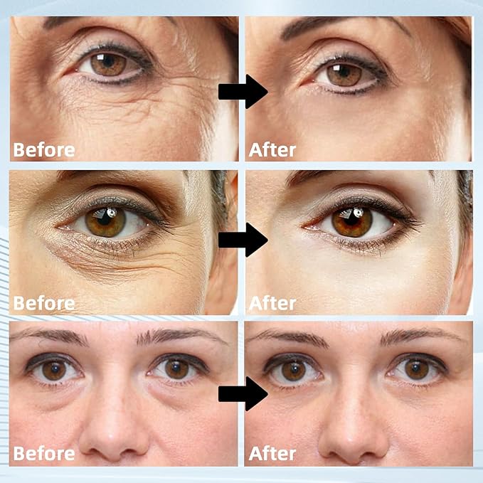 Under Eye Patches Masks for Eye Bags, Puffy Eyes, Fine Lines, Wrinkles, Dark Circles Treatment with Collagen and Retinol, Collagen Reduce Wrinkles Eye Masks, Lift, Firm Eyes Skin, 60 Pcs