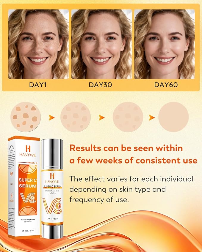 HANYWIL 20% Super Vitamin C Serum, Dark Spot Remover for Face, Hyaluronic Acid Total Package Serum, Targets Age Spots, Hydrates and Wrinkle Reduction 1.7fl oz