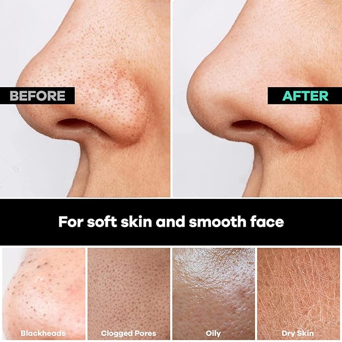 Dermasuri Deep Exfoliating Face Mitt - Scrubber, Dead and Dry Skin Remover for Men and Women - Exfoliator Gloves for Shower and Dry Use - (2 Pack)