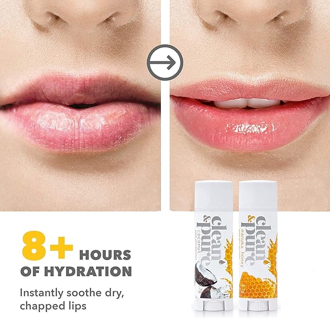 Lip Balm 2-Pack (Manuka Honey & Coconut) | Lip Care Set With 100% All Natural Beeswax | Vitamin E Oil…