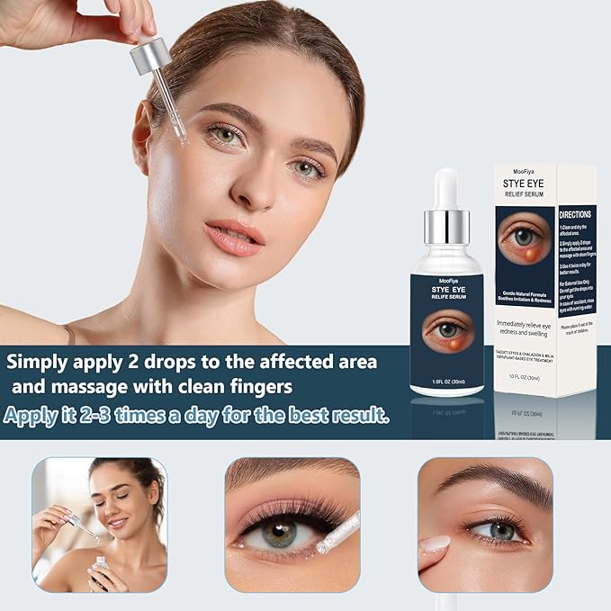 Stye Eye Treatment, Eye Reflief Serum for Styes and Chalazions, Non-Irritating, Eyelid Comfort Serum, Plant-based Formula, , (30ML-1 Fl Oz)
