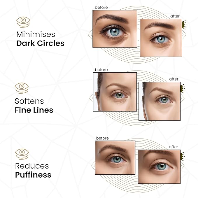 Gold under EYE Collagen Gel Mask, Nourishes, Firms & Hydrates, Puffy Eyes & Dark Circles, Hyaluronic Acid (30 Pairs - Jar)