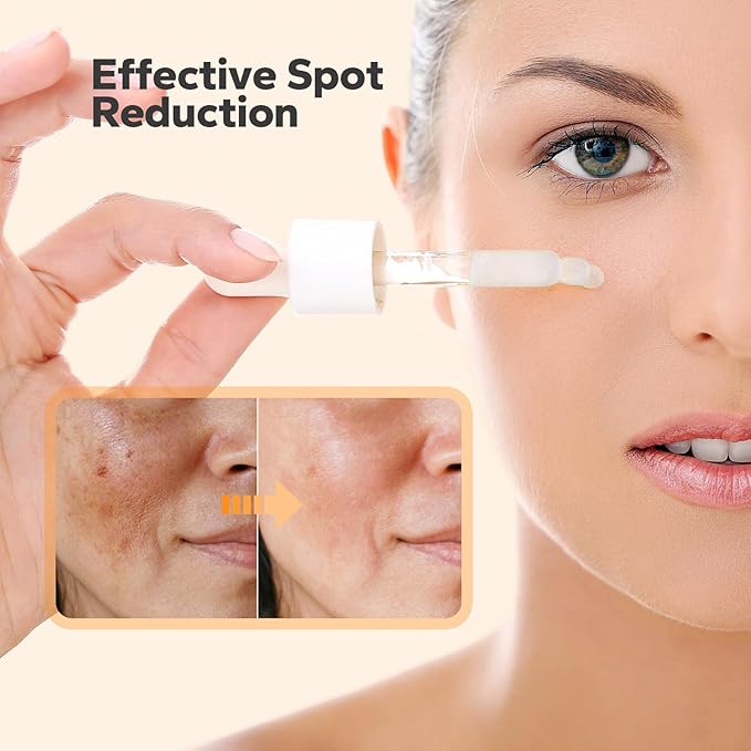 Dark Spot Correcting Serum (1 fl.oz), Dark Spot Improver for Face & Body, Niacinamide Serum for Uneven Skin Tone, Sun Damage, and Age Spots, Hyperpigmentation Solution