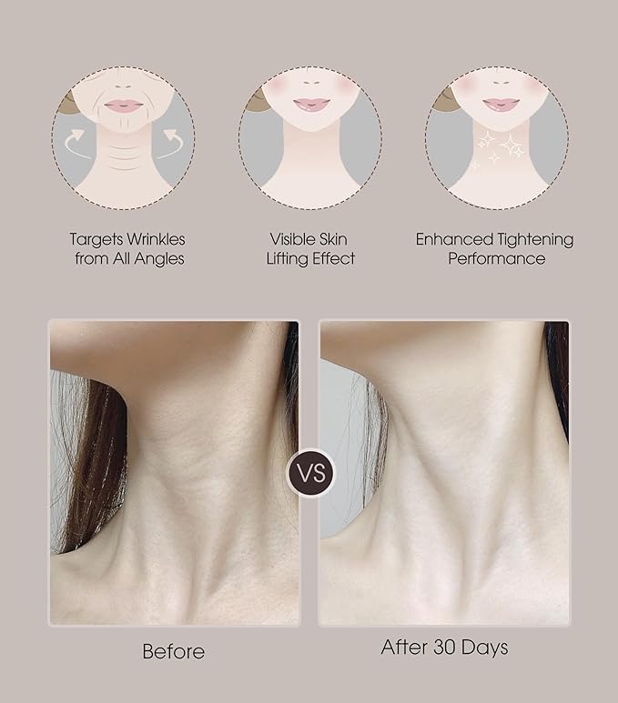 Intelligent Neck Lifting Device, 3 Color LED Neck Massager with Remote Control for Facial Massager | at Home Skin Care Tool