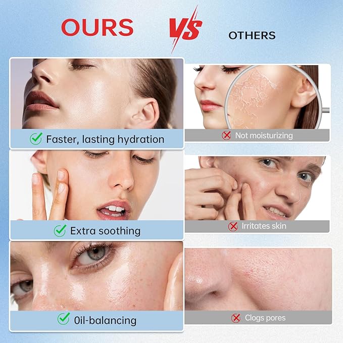 VGO Snail Mucin 92% Moisturizer Daily Face Moisturizer Hydrating Repair Face Gel Cream for Dry & Sensitive Skin, All Skin Types 50g / 1.76oz