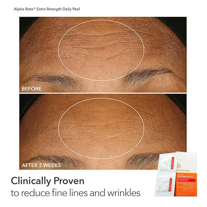 Dr Dennis Gross Peel Vault Kit – 30 Alpha Beta® Extra Strength Daily Peels + 60 Universal Daily Peels | 90 Total Treatments | $245 Value Limited Edition