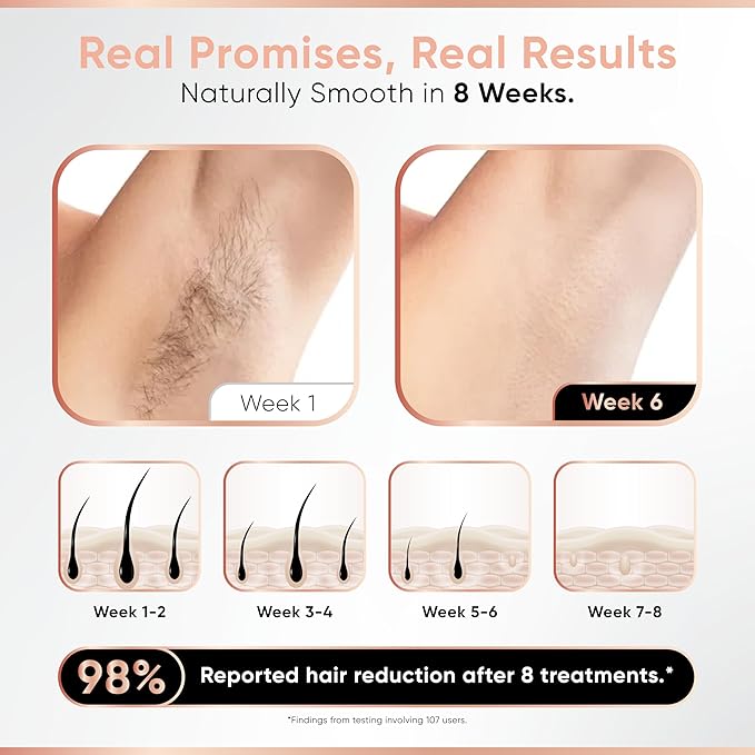 Sensica Cordless SensiLight PRO Rechargeable RPL Hair Removal Device – Permanent IPL for Women and Men – Painless, Unlimited Flashes, Wireless at-Home Body & Facial Hair Remover – XL Window 1.4x0.5