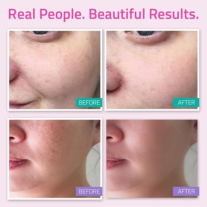 YEOUTH Skin Care Set: Hyaluronic Acid Serum for Face, Vitamin C Facial Serum, Face Cleanser, Toner & Cream, Hydrating Skin Care Kit 5-Piece