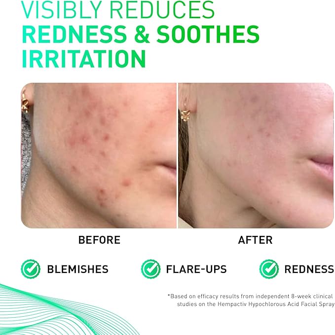 Hypochlorous Acid Spray for All Skin Types – Calm, Hydrate + Soothe – Daily Toner – Pure Unscented, 8 Fl Oz