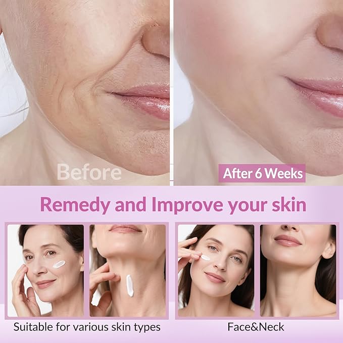 Neck Firming Creams for Tightening and Firming, Moisturizer Face Cream with Collagen, Hyaluronic Acid, Day & Night Anti-Aging Skin Tightening Cream Neck, Décolleté & Face – 1.7Fl Oz