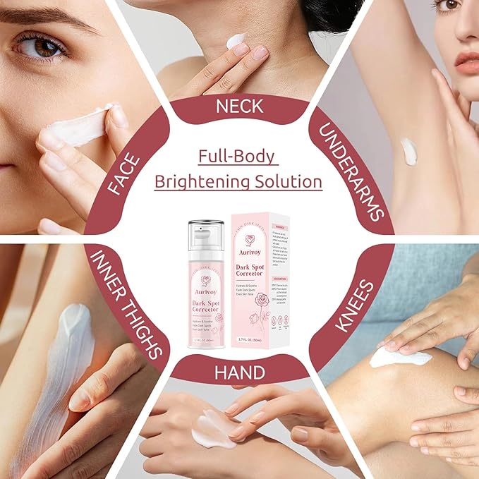 Dark Spot Remover for Face and Body - Dark Spot Corrector for Face - Sun Spots, Age Spots, Freckles & Melasma Remover - Brown Spot Corrector Evens Skin Tone for All Skin Type 1.7 Fl Oz