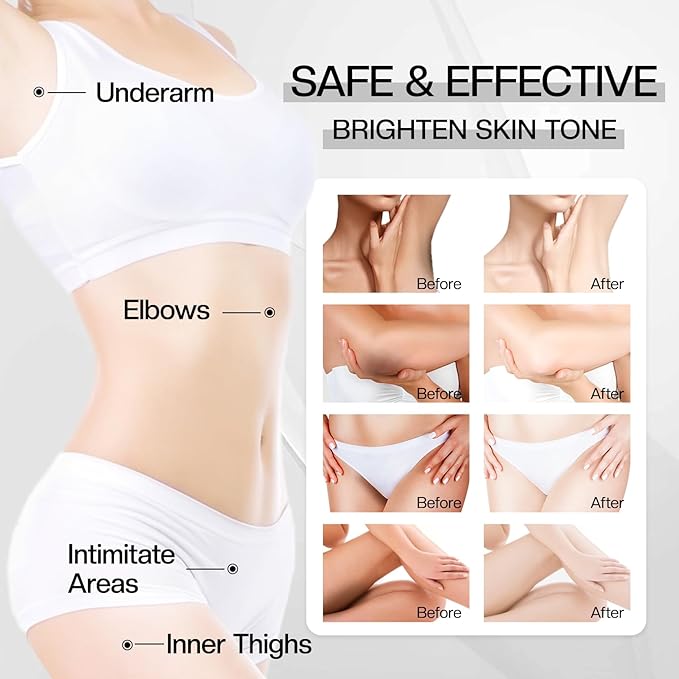 Dark Spot Correcting Cream: Retinol & Vitamin C Advanced Facial Treatment for Hyperpigmentation Natural Ingredient - Dark Spot Remover for Face and Body 1.7 floz