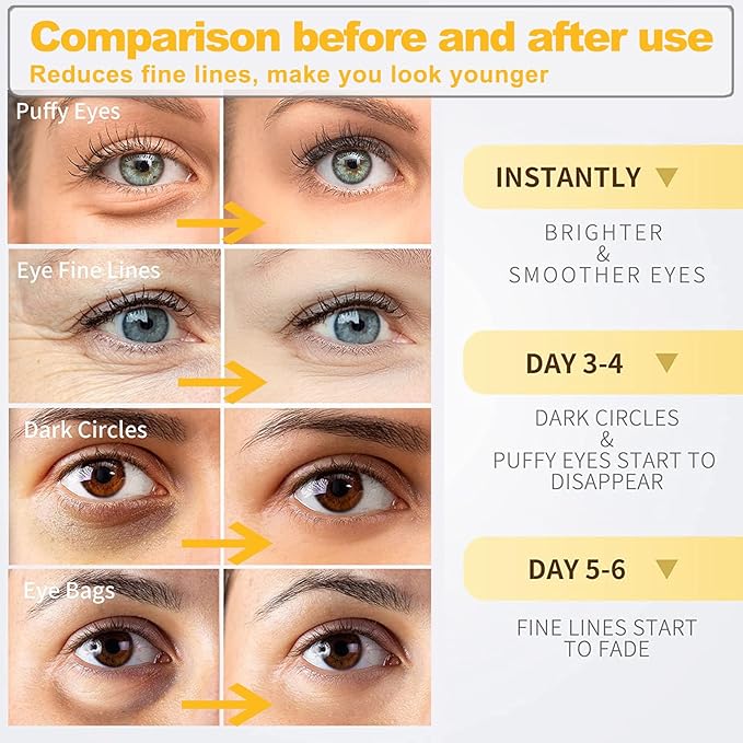 24k Gold Under Eye Patches, Eye Masks for Puffy Eyes 60 pcs, for Dark Circles and Puffiness, Hydrating Eye Mask Skincare, Eye Gel Pads for Eye Bags and Wrinkles Under Eye Treatment