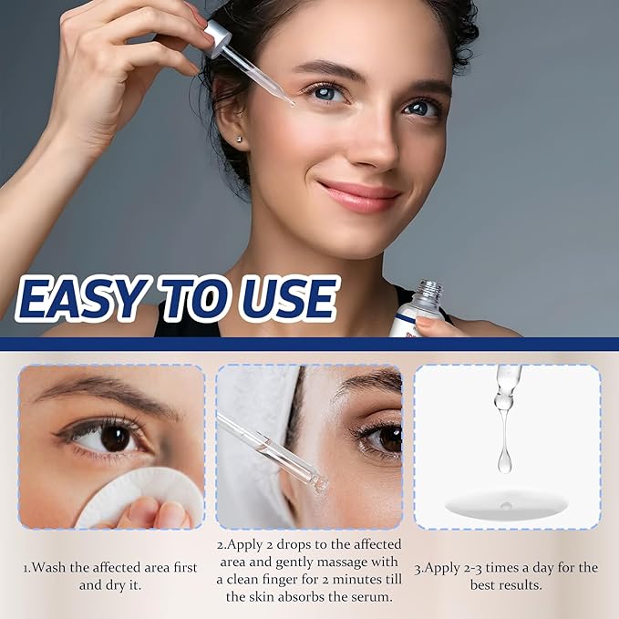 Stye Eye Treatment, Chalazion Treatment Serum, Stye & Blepharitis Remover with Hippophae Rhamnoides Fruit, Helichrysum Angustifolium Flower & Persea Gratissima Oil (1 Fl. OZ (Pack of 1))