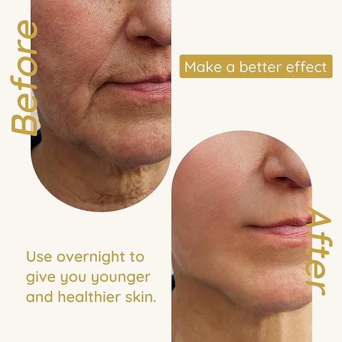 Enaskin Naturals Anti Wrinkle Face Patches Anti Wrinkle Gel Face Masks (1 Pack)