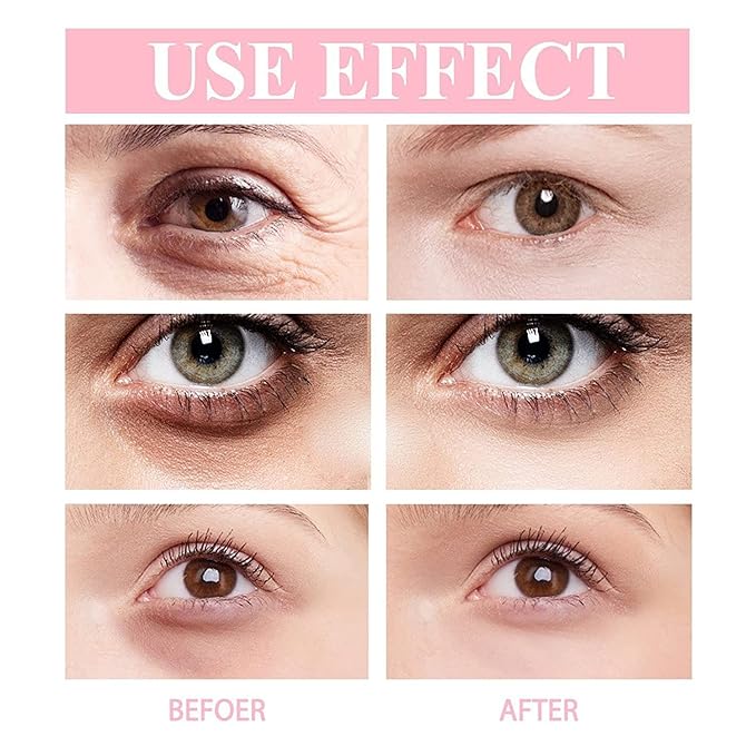 Retinol Polypeptide Eye Cream,Retinol Eye Cream for Dark Circles and Puffiness, Visible Results in 3-4 Weeks, Under Eye Cream for Anti Aging, for Puffiness and Bags to Reduce Fine Lines(2pcs)