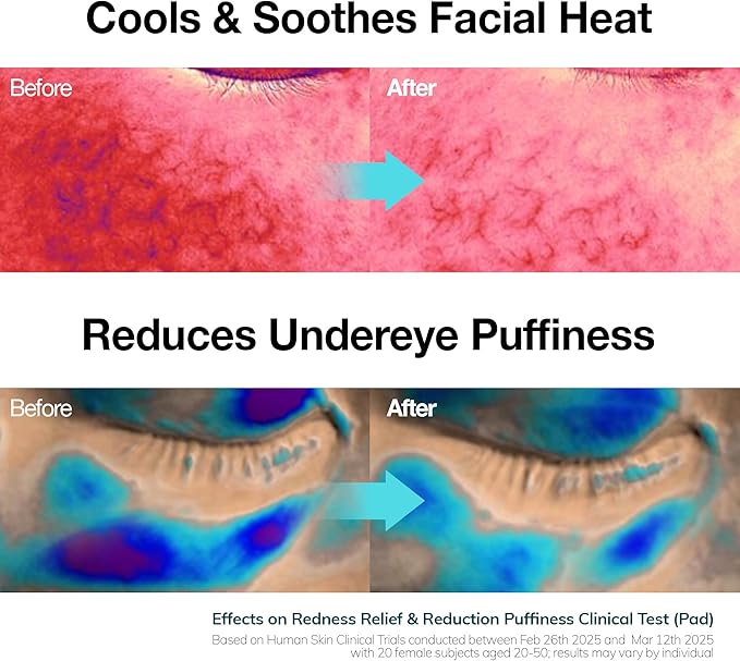 Ice Sorbet Toner Pads | Skin Prep Wipes for Puffiness, Under Eye Bags & Instant Face Lift | Gel Pads for Sunburn Relief & After Sun with 30% Glacier Water & Caffeine | 7.43 Fl Oz / 60 Count