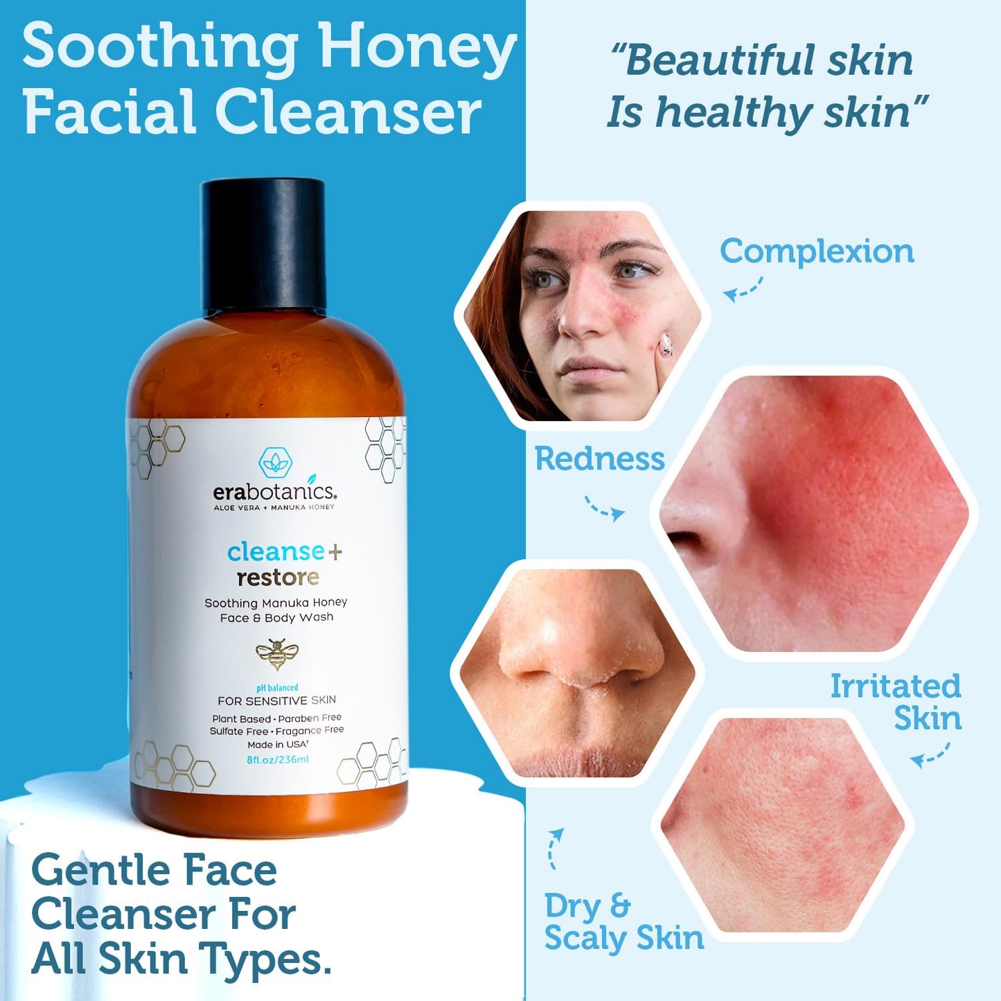 Manuka Honey Face Wash for Women and Men - Sulfate Free Moisturizing Cleanser with Organic Aloe Vera - Soothing Plus Gentle on Dry Skin Facial Cleanser Made in USA - 4oz