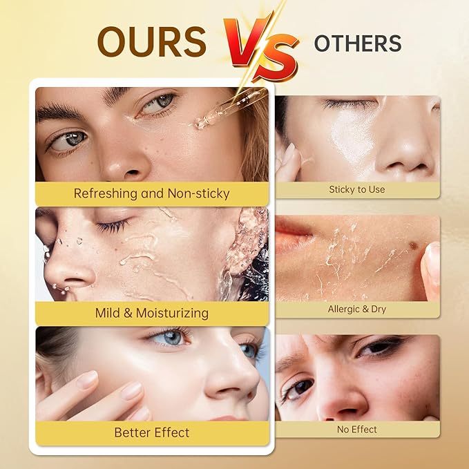 Vitamin C Face Serum with Vitamin C, Hyaluronic Acid, Vitamin E, Serum for Dullness, Balanced Complexion, Eye Area, Fine Lines & Wrinkles, 30ml/1.01oz