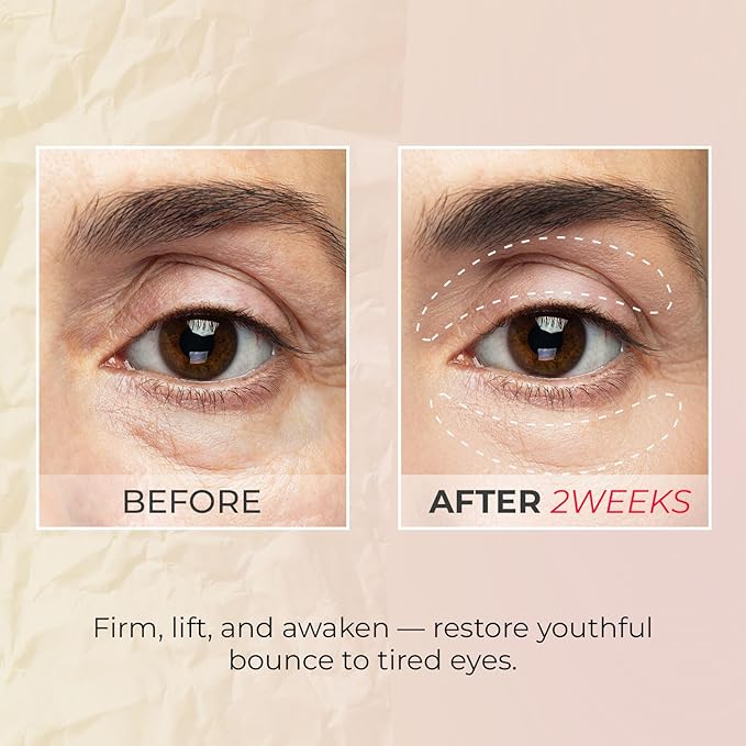 Look at Me Teen Again Eye Cream, Anti-Aging Line Smoothing Skin Care Treatment, Wrinkle Care, Cruelty Free, for Women and Men 0.84 fl. oz, 25ml