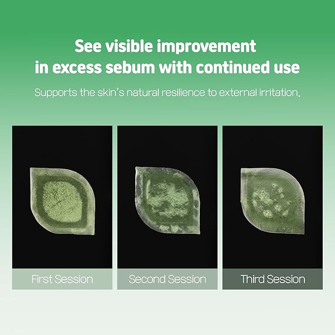 Cica Bio Spot Control Patch (1 Box, 62pcs) | Soothing Acne Patch for Redness & Blemishes | With Cica, Niacinamide & Tea Tree | Gentle for Sensitive Skin | Korean Skincare