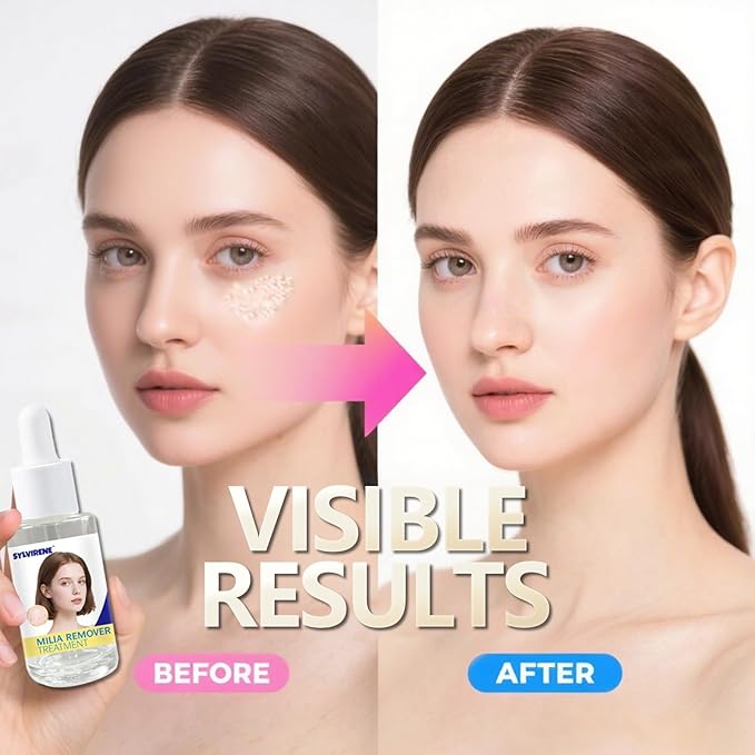 Milia Spot Treatment Serum with Salicylic Acid - Eases Milia-Caused Roughness & Graininess - Milia Remover for Eyes & Face - 40ml