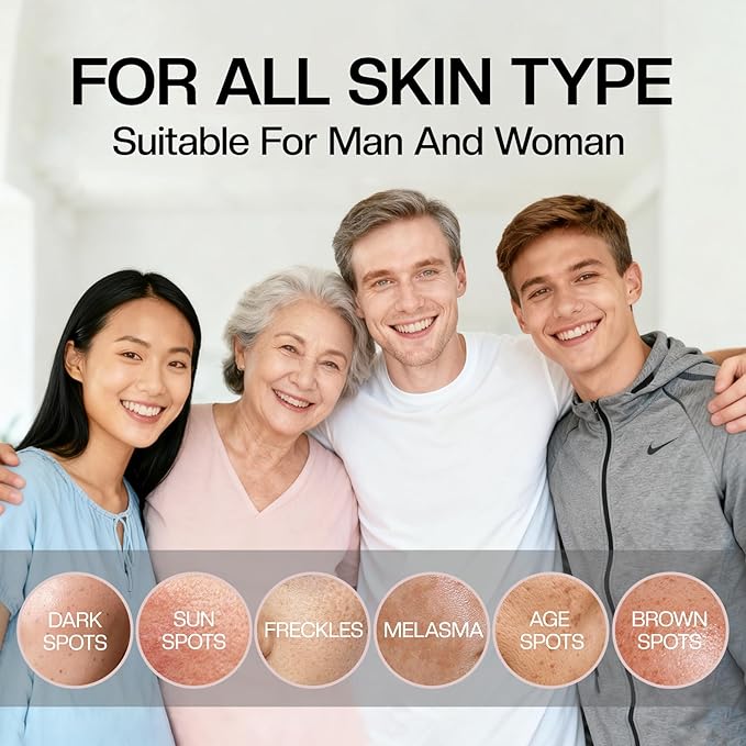 Dark Spot Correcting Cream: Retinol & Vitamin C Advanced Facial Treatment for Hyperpigmentation Natural Ingredient - Dark Spot Remover for Face and Body 1.7 floz