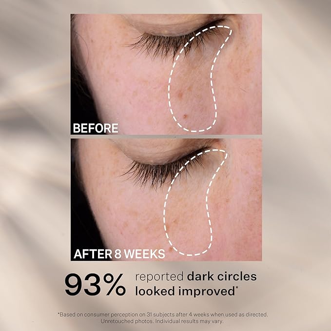 StriVectin Super C Dark Circle Brightening Eye Serum, 0.5 oz